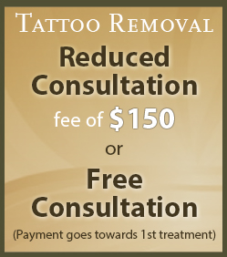tattoo removal - banner