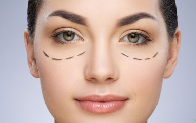 Non-surgical Under Eye Bag 
                                Removal