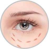 Dark Circle Removal