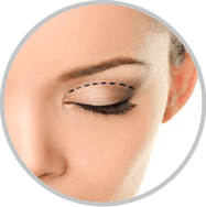 Droopy Eyelid Repair