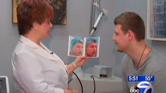 Watch Video: Dr. Hellman Featured on ABC News Discussing Laser Acne Treatment Fractora