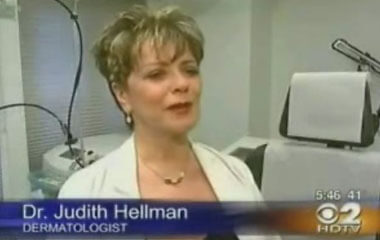 Watch Video: Dr. Hellman featured on CBS News speaking about Laser for Acne Treatments